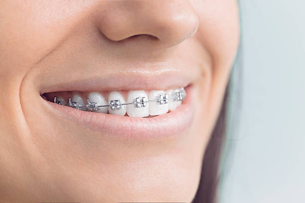 Why Choose Us for Your Dental Needs in Woodbury, MN